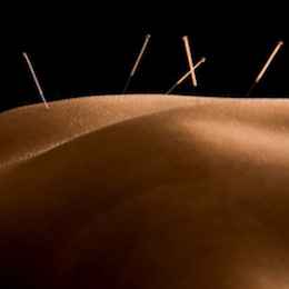 gentle acupuncture needles